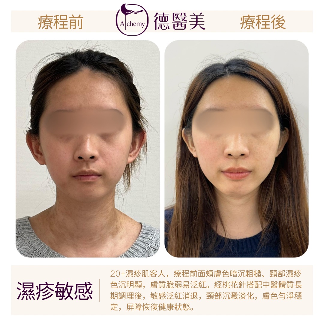 案例