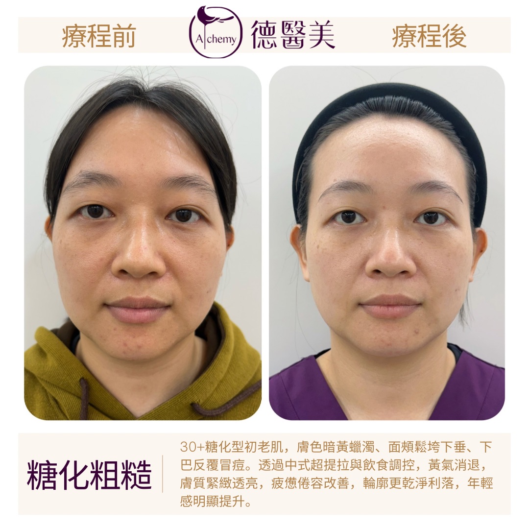 案例