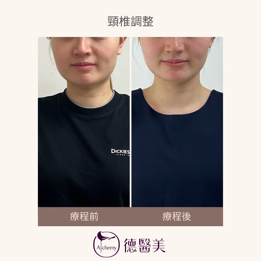 案例