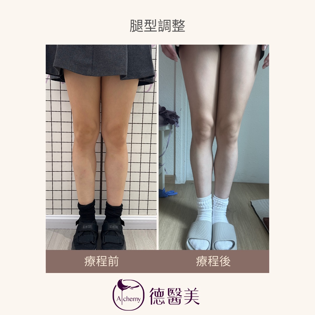 案例