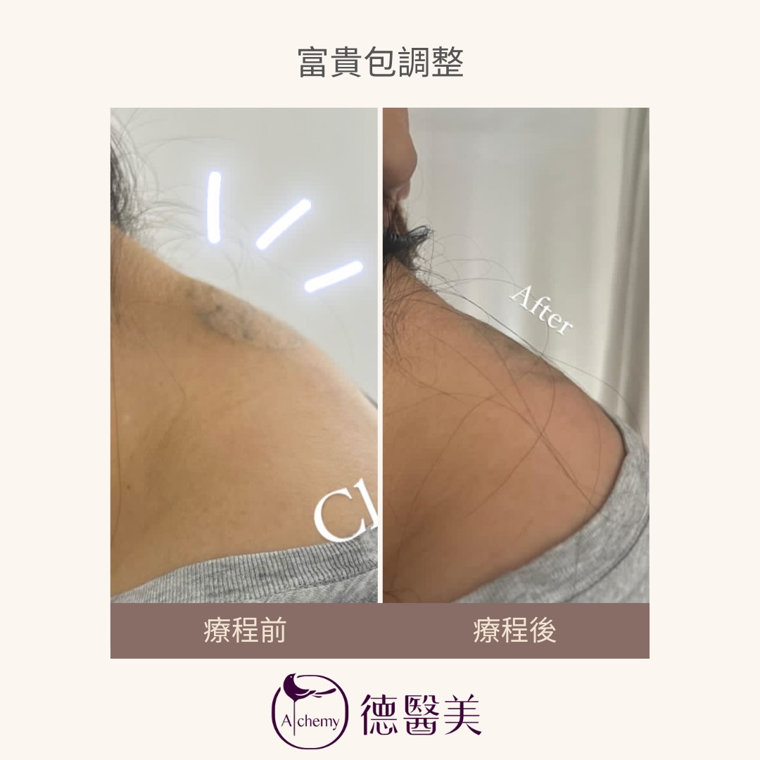 案例