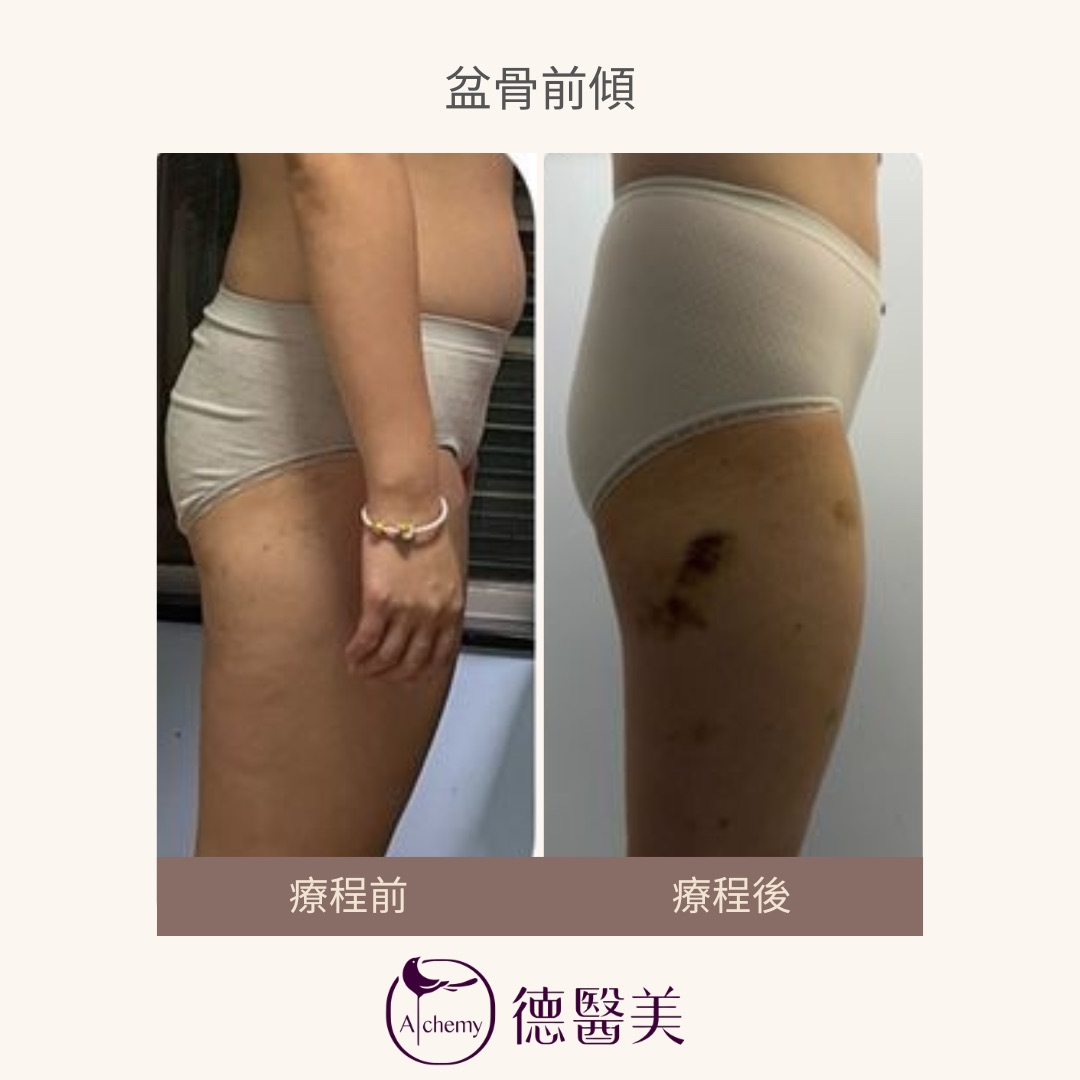案例