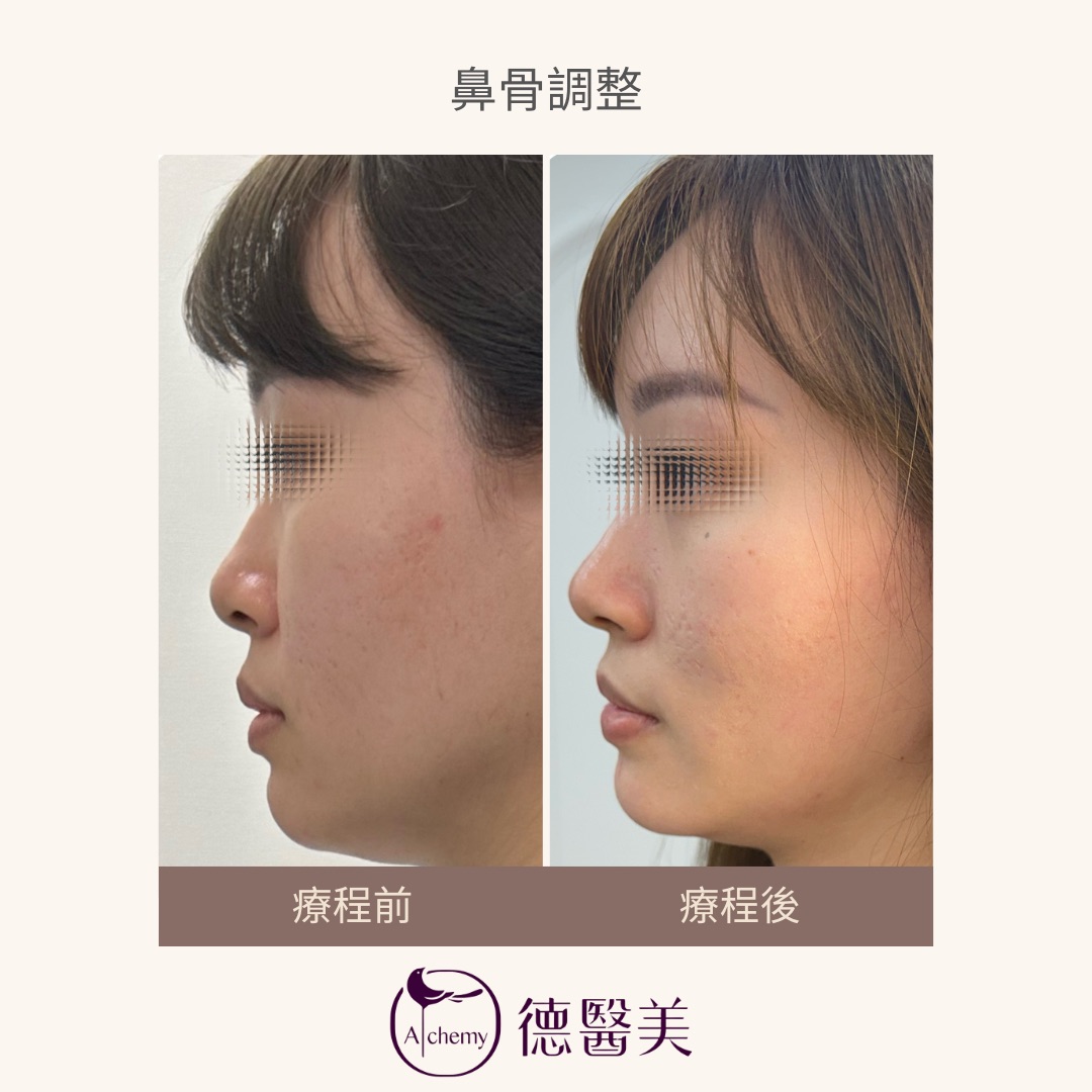 案例